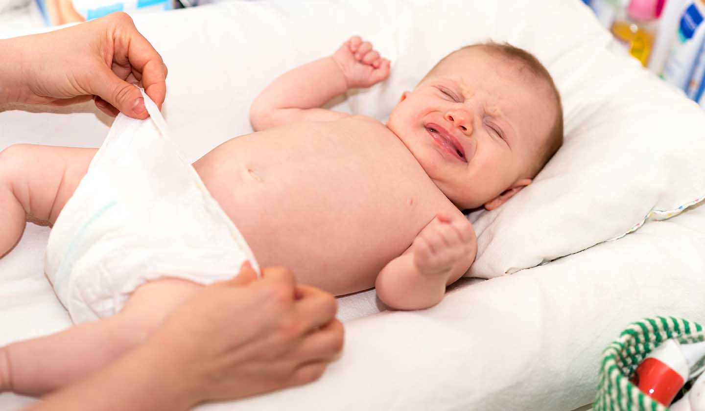 Desconforto provocado pelo eritema da fralda