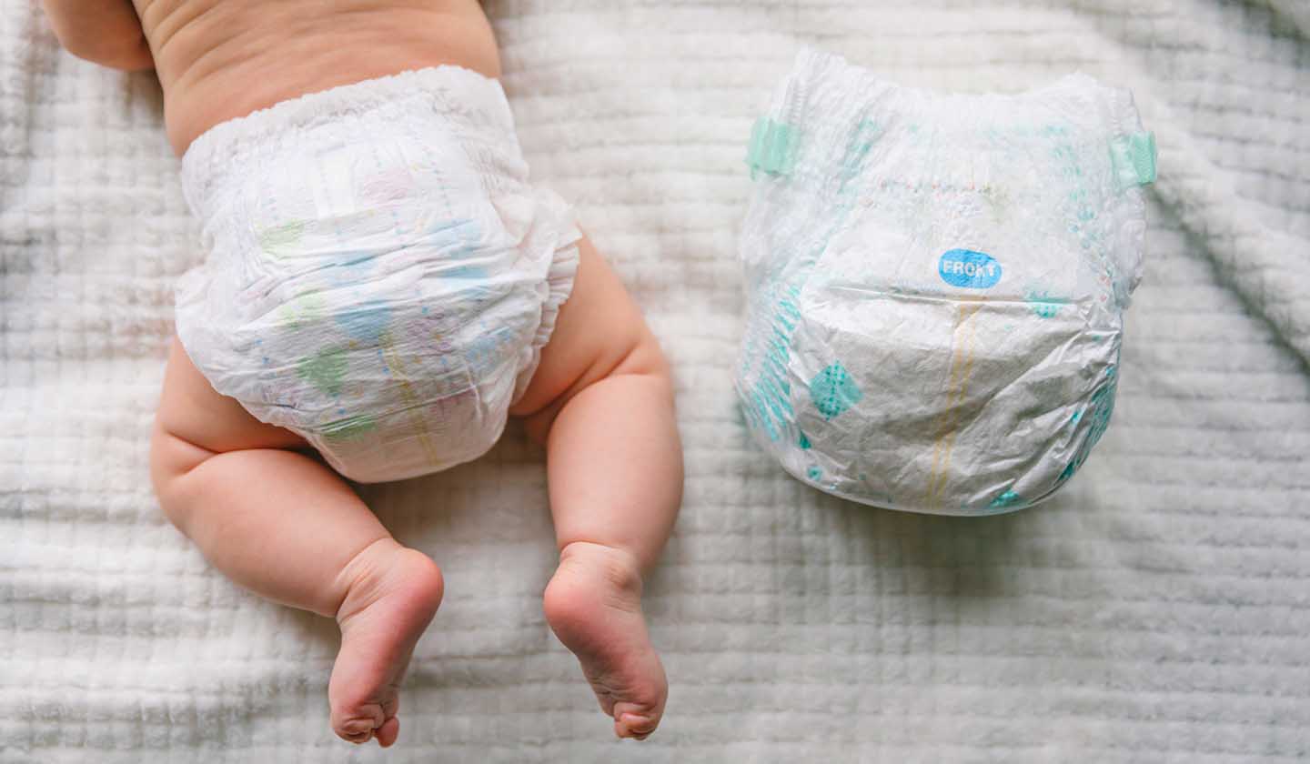 Cuidados para prevenir o eritema da fralda