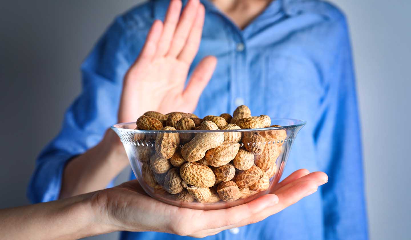 Alergia grave a alguns alimentos