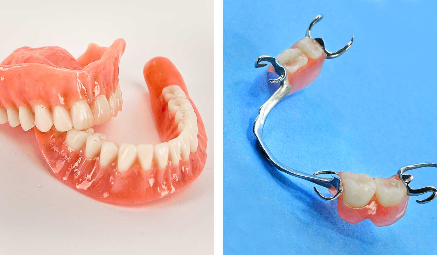 Prótese Dentária Removível