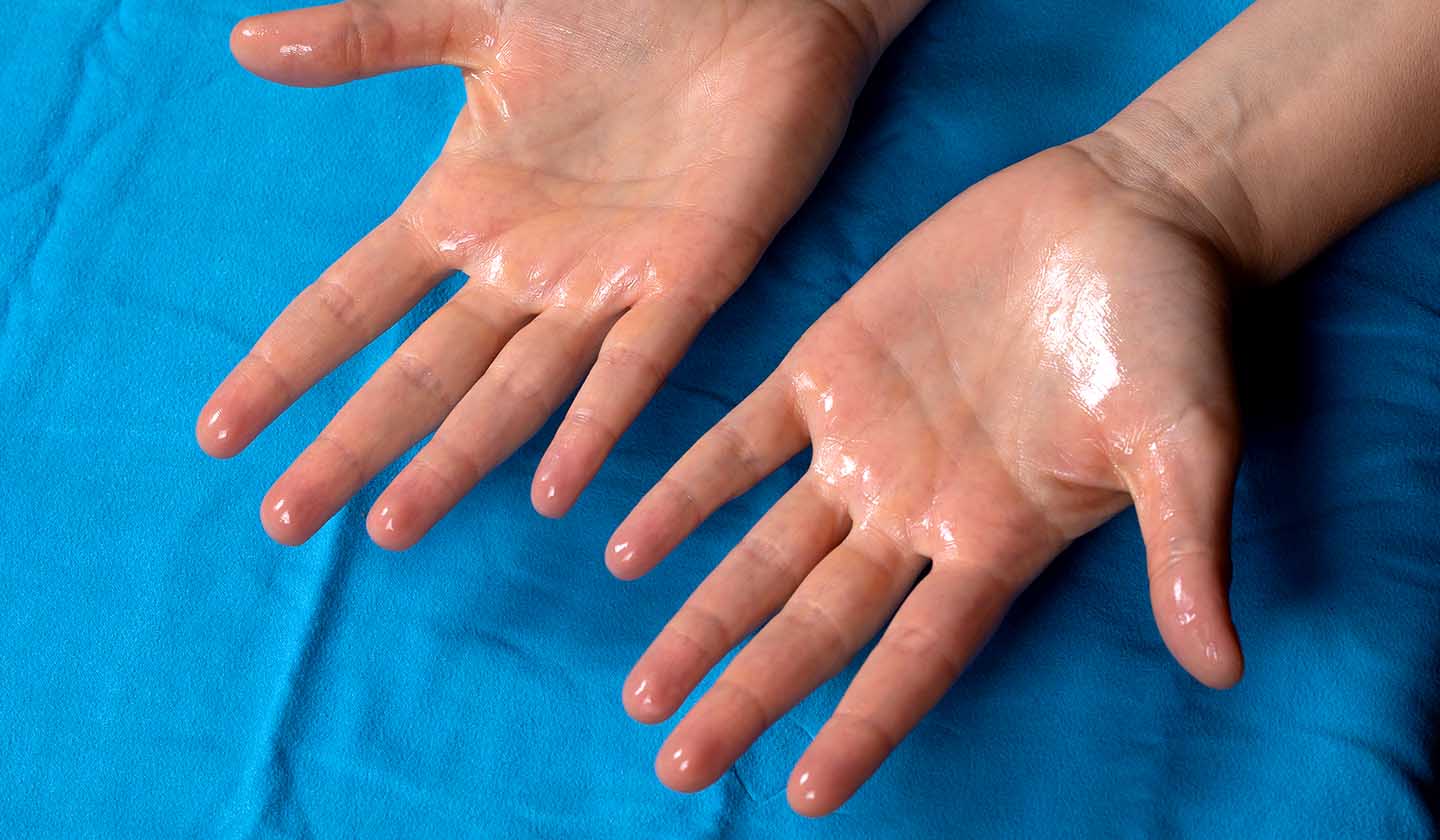 Transpiração excessiva Sintomas 