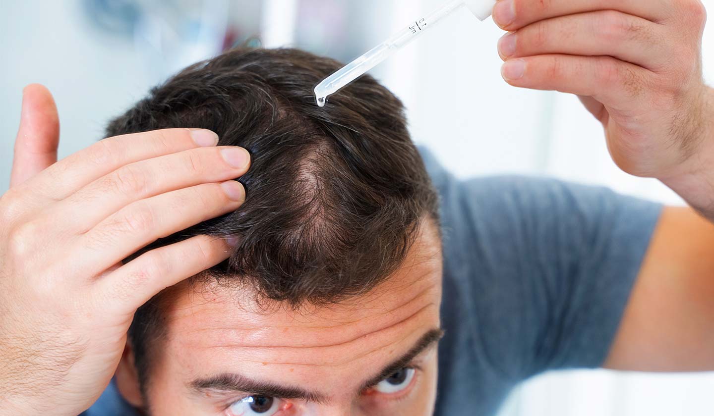 Problemas do couro cabeludo