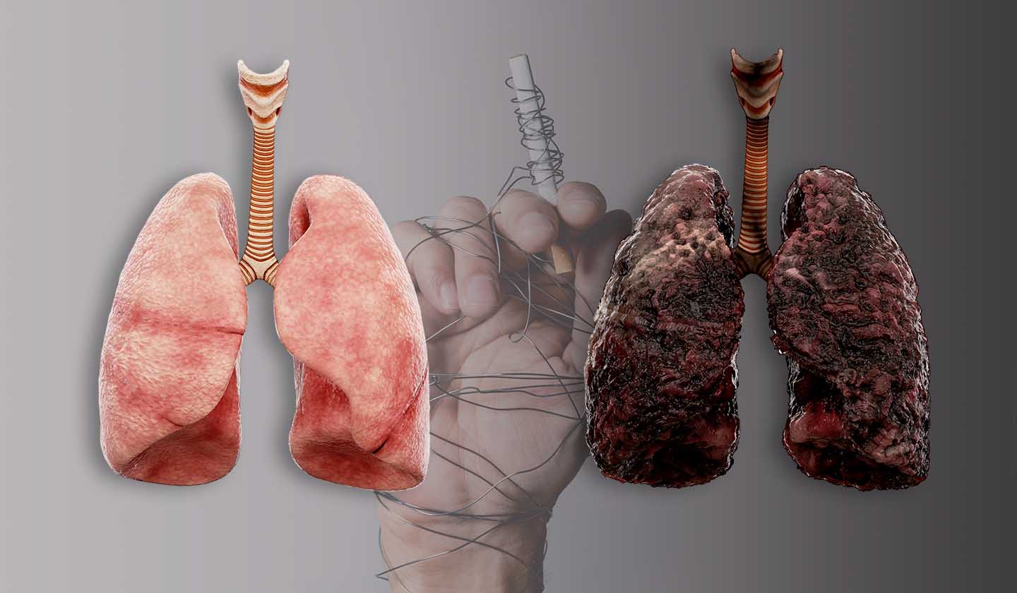 Efeitos da dependência da nicotica