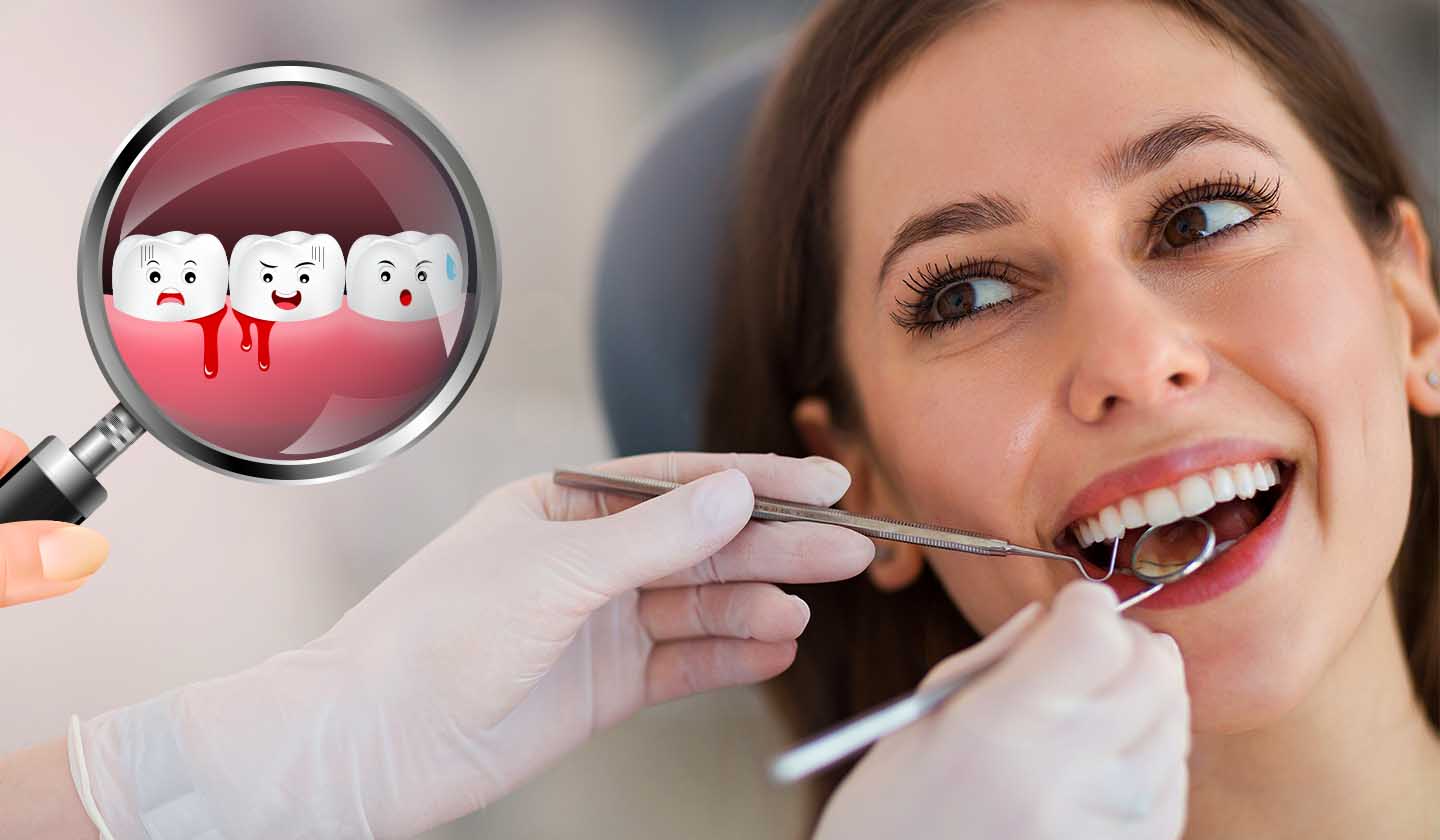 Sangramento das gengivas