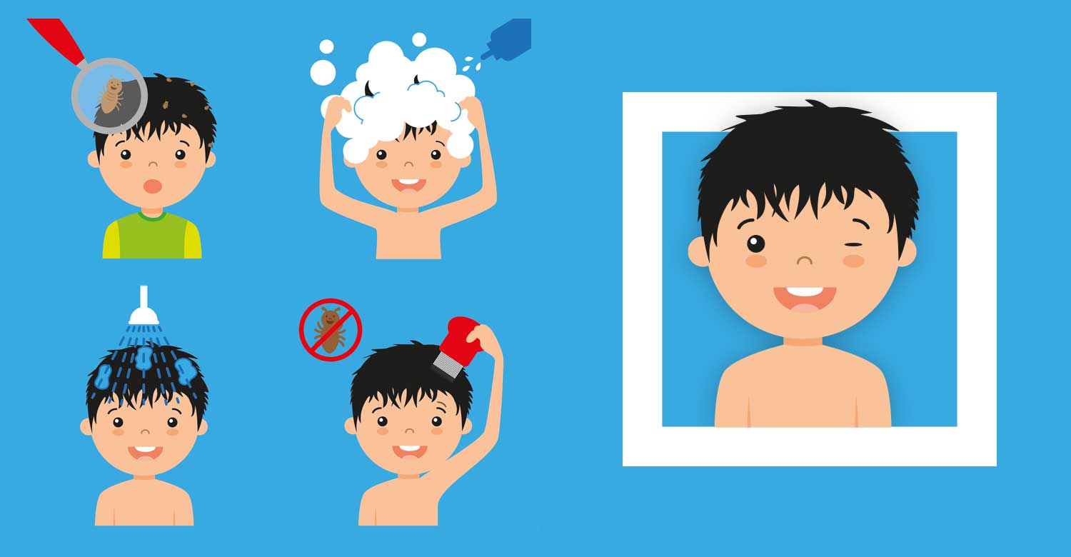 Processo de tratamento da pediculose